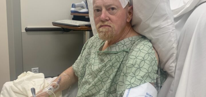 deep brain stimulation surgery